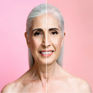 Aesthetic Orthobiological Procedures